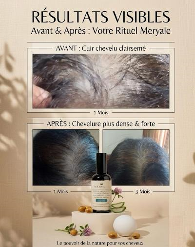 Avant&Aprés